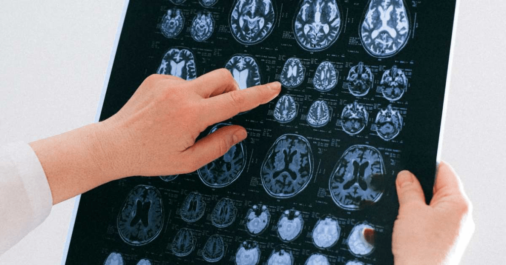 Magic or Reality? AI is Already in Your&nbsp;Head